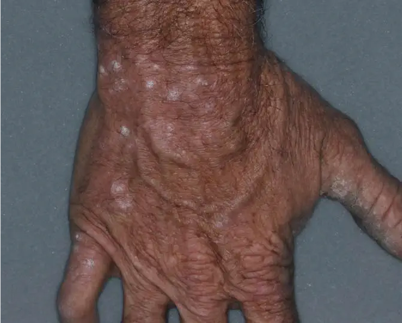 Hand - Week 8 IGA = 2