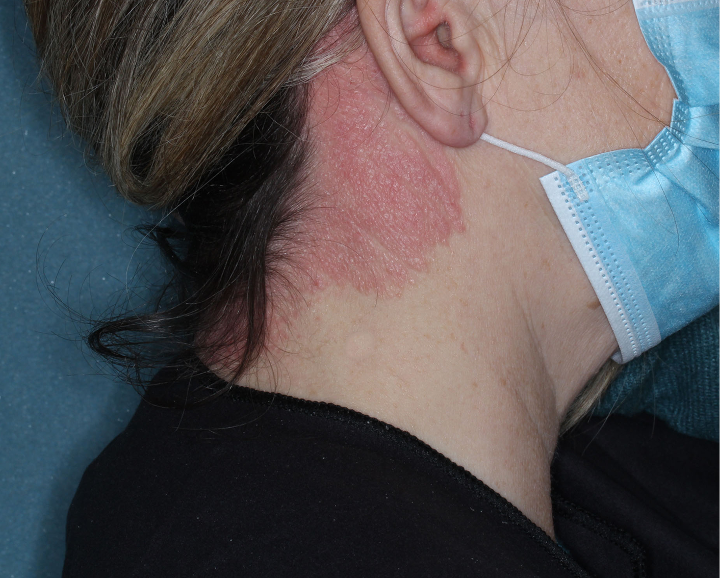Baseline: S-IGA = 3