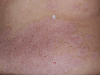Image of trunk at week 8