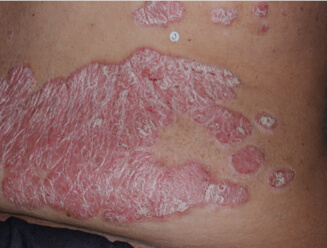 Image of trunk at baseline