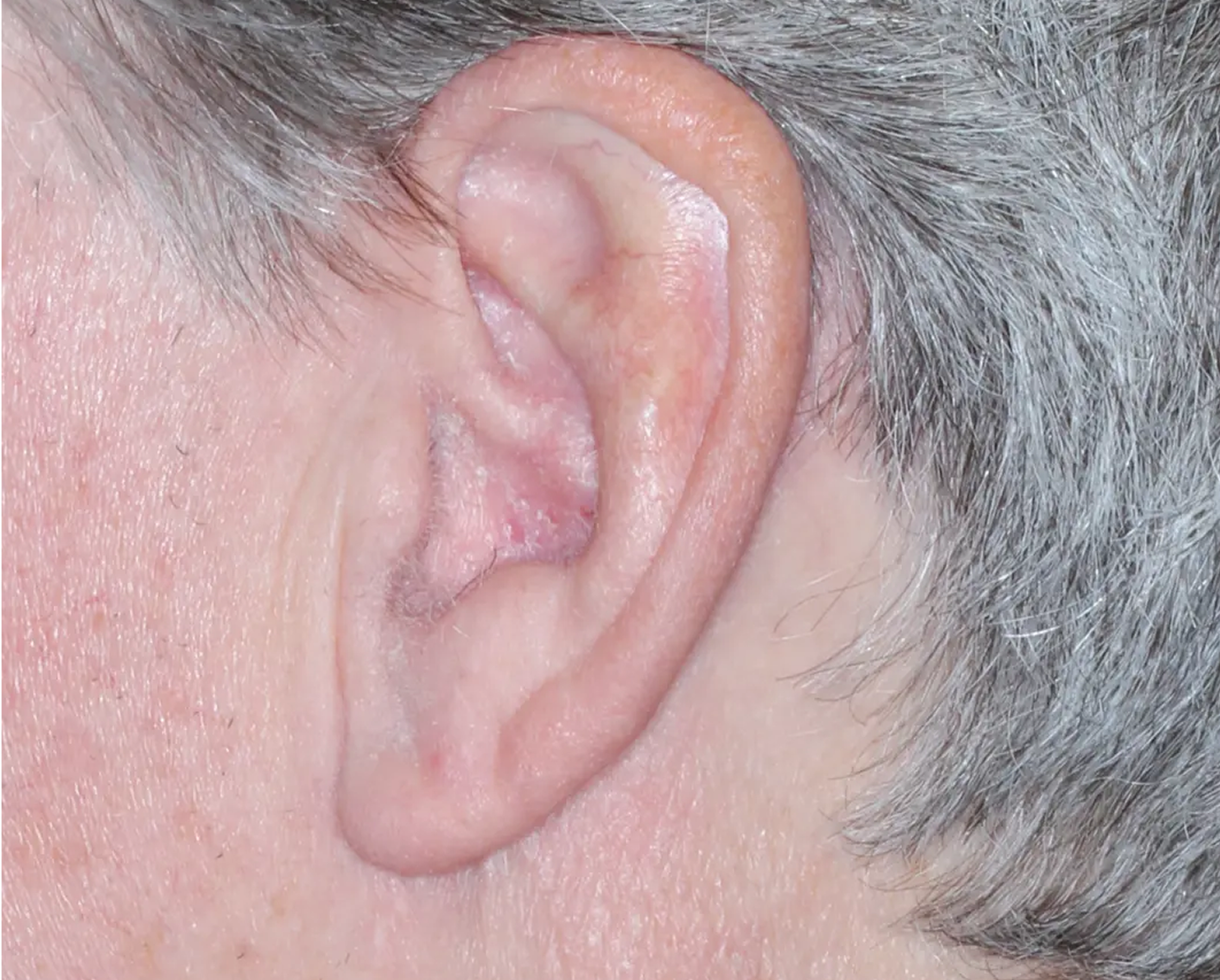 Image of ear at week 2