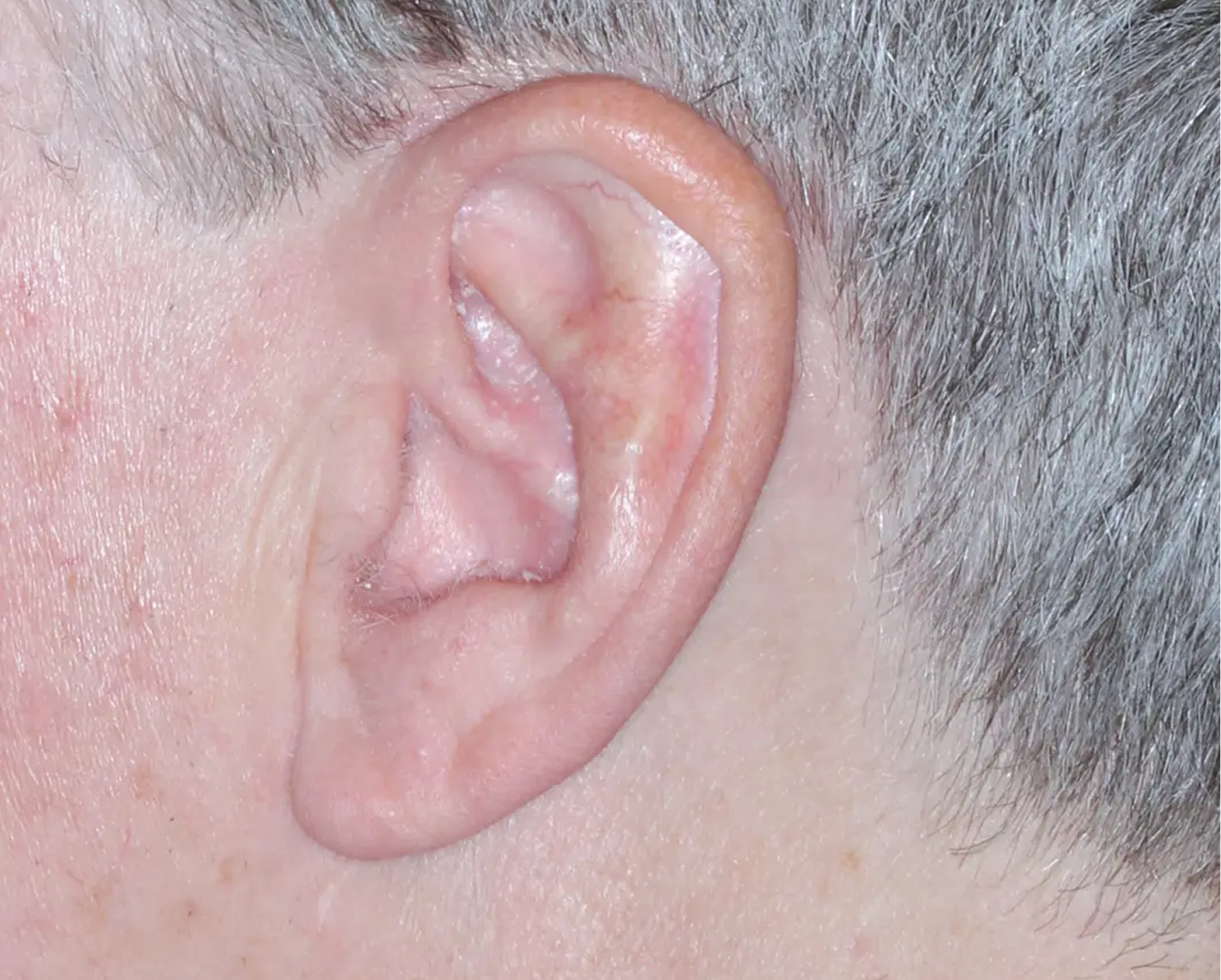 Image of ear at week 4