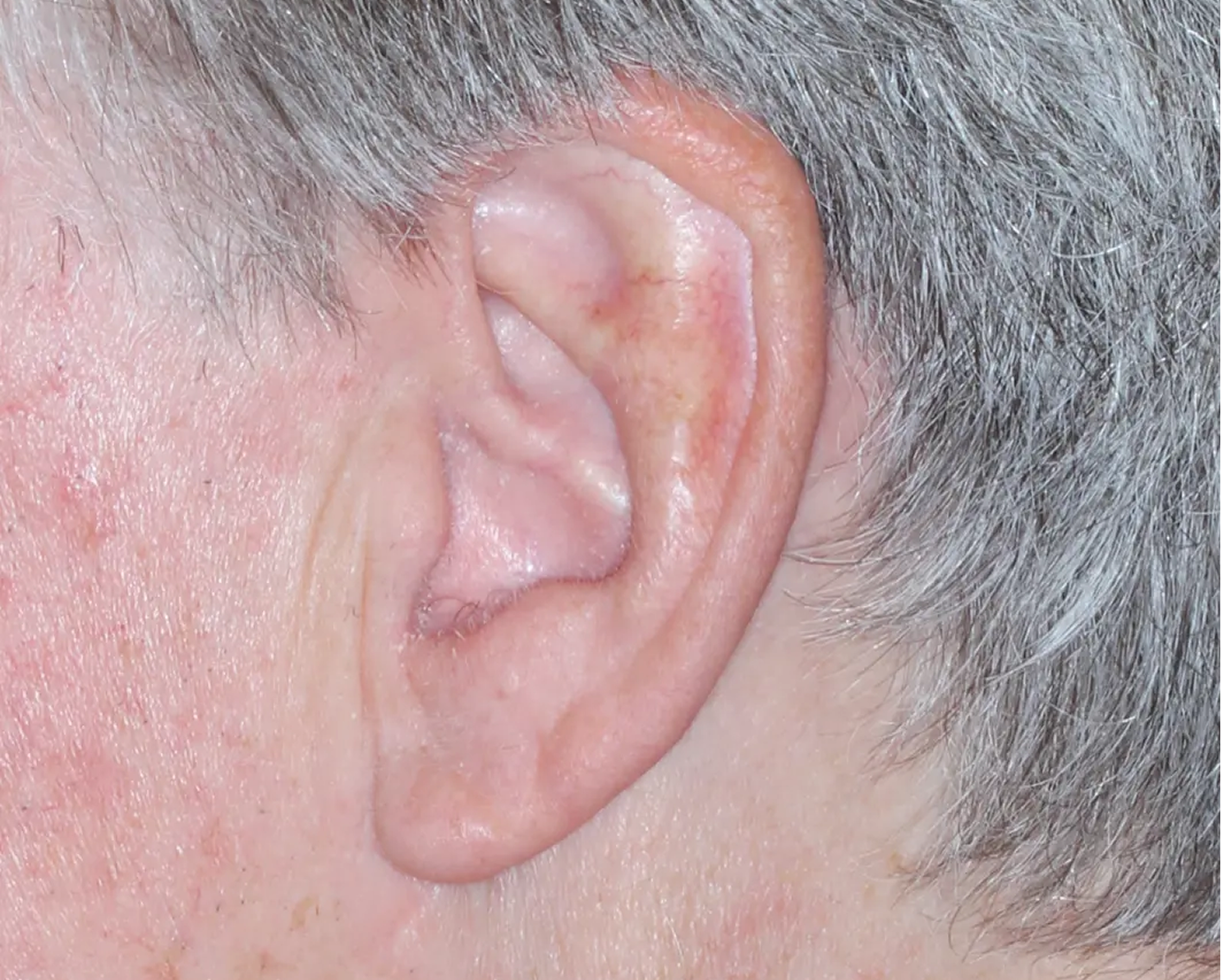 Image of ear at week 8