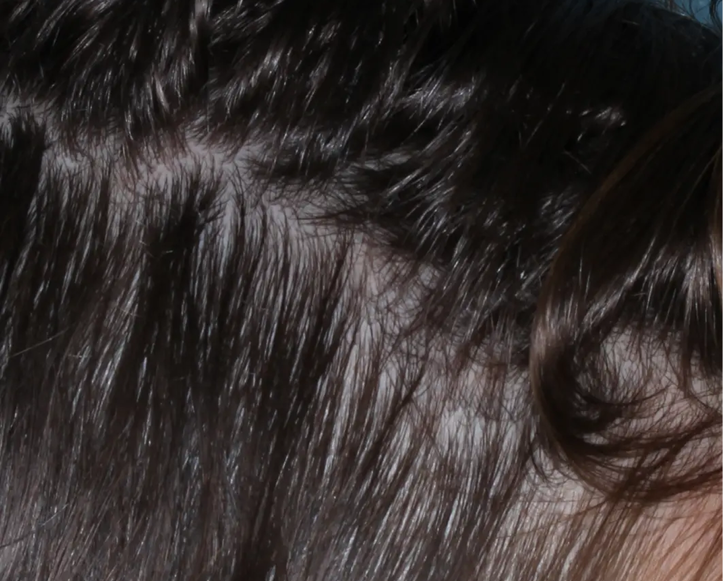 Image of scalp at week 8