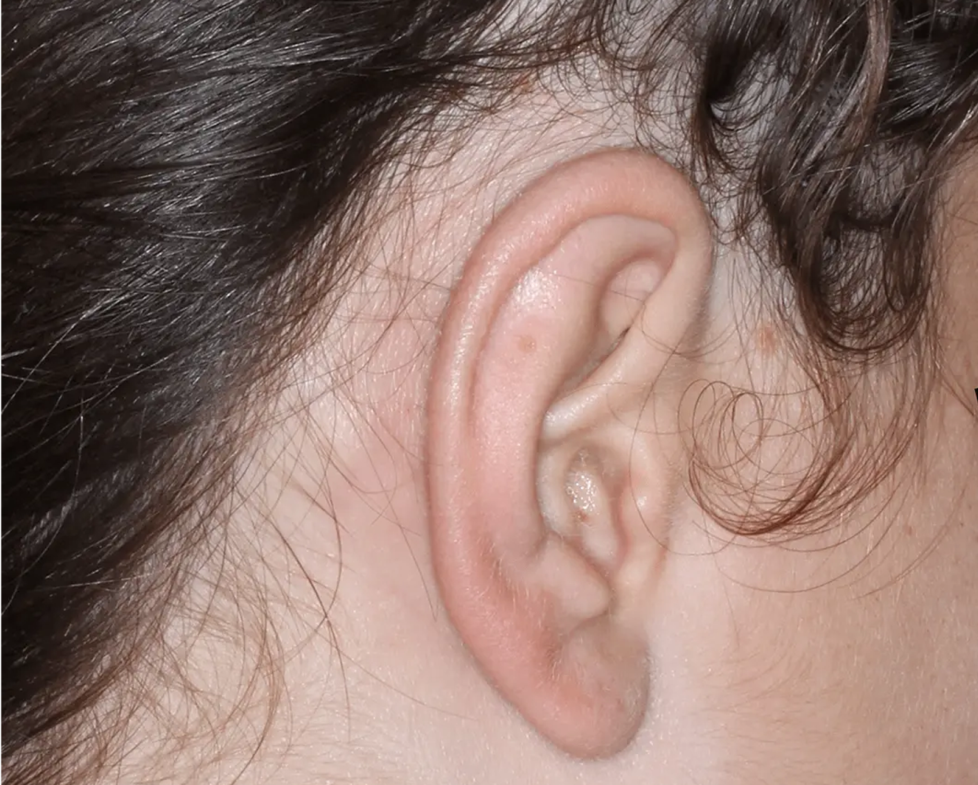 Image of ear at week 2