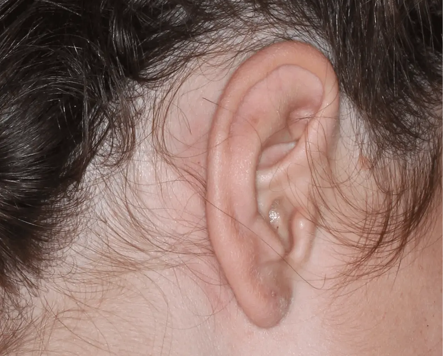 Image of ear at week 4